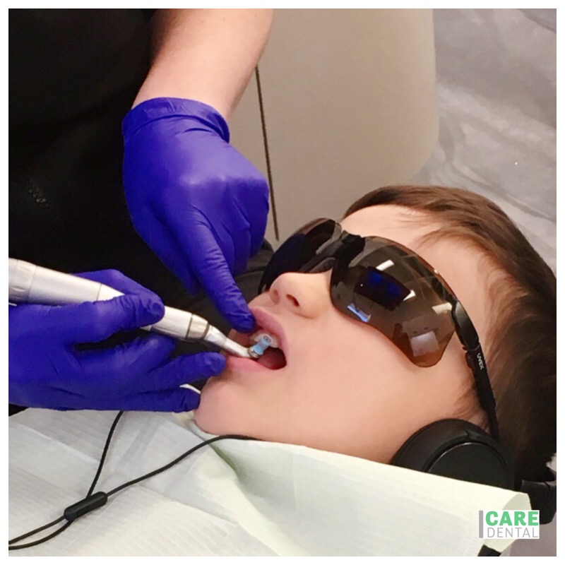 Next time you or your #CoolKid come in for a cleaning, don’t forget to ask for an ortho-check from #DrChad We love all teeth, but the littlest ones are our favourites ???? Would you like to learn more about CareOrtho? Click the “learn more” button. Are you ready to check-in? ????‍ Direct message us here 24/7 or call 778-484-CALM (2256) to reserve your booking. We always look forward to hearing from you. #whosyourdentist Dr. D. Kobi Inc. dba Care Dental is a BC Dental Corporation. Dr. Dan Kobi, General Dentist and Dental Team Leader Associate Dentists: Dr. Chad Fletcher, General Dentist Dr. Sophia L. Dahia, General Dentist Dr. Steven Bray, General Dentist . . . . . #Spa-inspired #carekids #nothingbutthetooth #ylw #emergencydentist #orthodontics #invisalign #generaldentist #cosmeticdentist #openlate #DentalSurgery #OpenSundays #metime #youdeserveit #flossome #youveearnedit #builtforyou #smilesformiles #SleepDentistry #DentalSurgery #SedationDentistry #RegisteredDentalHygienist