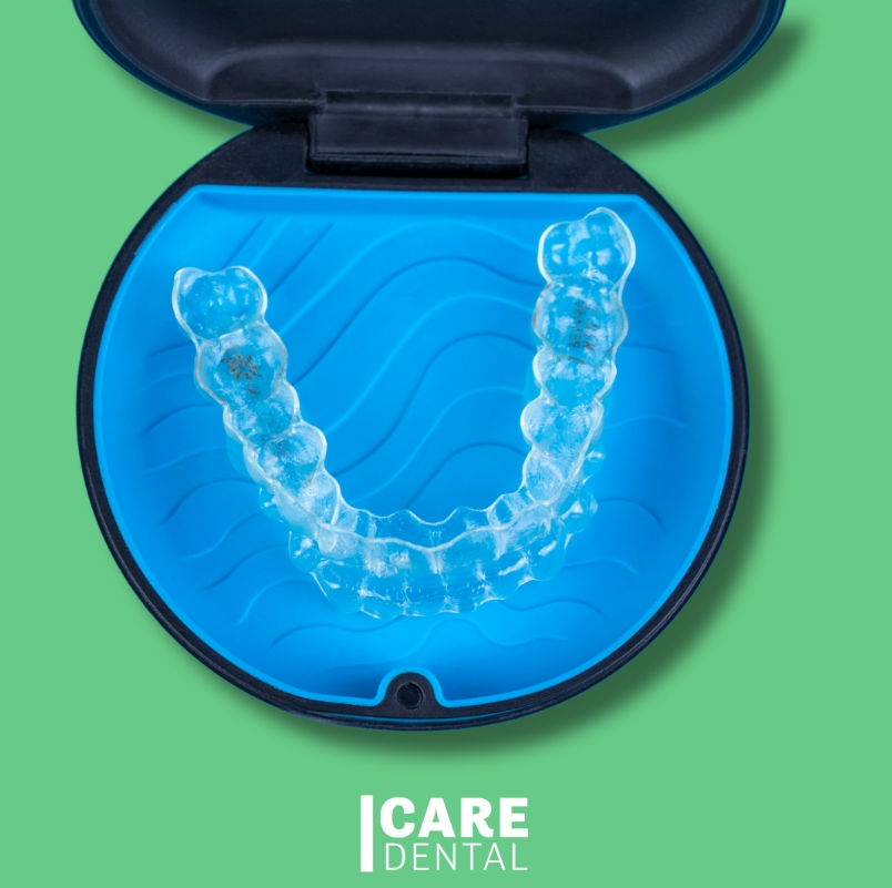 We are GOLD level Invisalign providers! These clear aligners are a cutting-edge ortho solution. The aligners are discreet, and gradually shift your teeth into the desired position. They apply the right amount of gentle pressure to the right place at the right time! You can remove them when you eat, allowing you to enjoy your favorite foods and take them out for cleaning. Call us for a no charge ortho consult