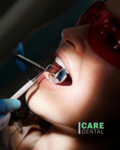 Student Insurance Blackout Over. Kelowna Student Dental Options